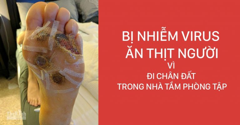 Đi chân đất trong phòng tập gym bị nhiễm virut ăn thịt người