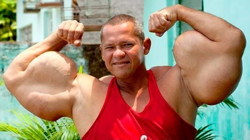 Bi kịch của ngôi sao cơ bắp Popeye Brazil